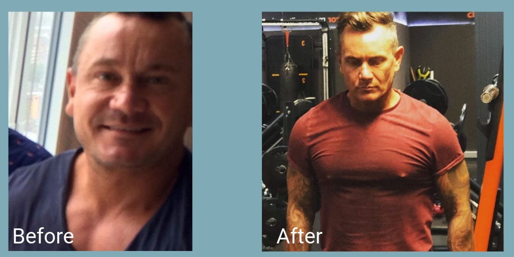 before and after mens health nightingale hospital anxiety inspiration